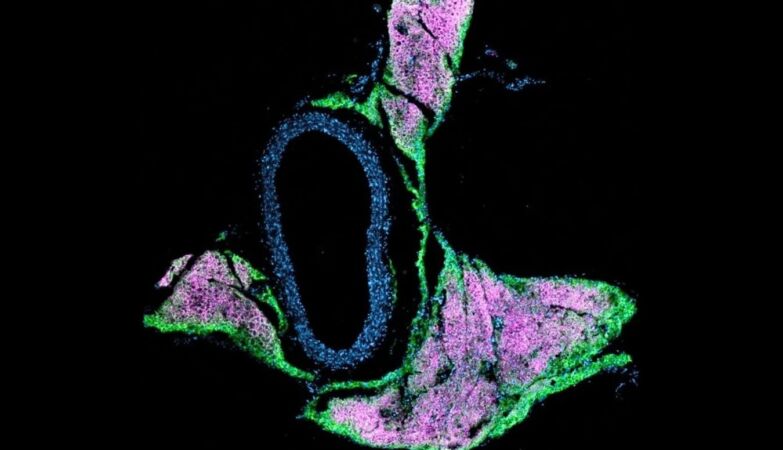 What is the mysterious beige fat