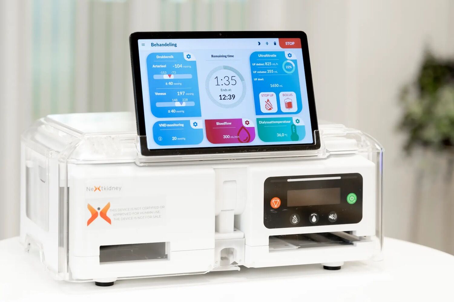 Kidneys: new machine “frees” patients