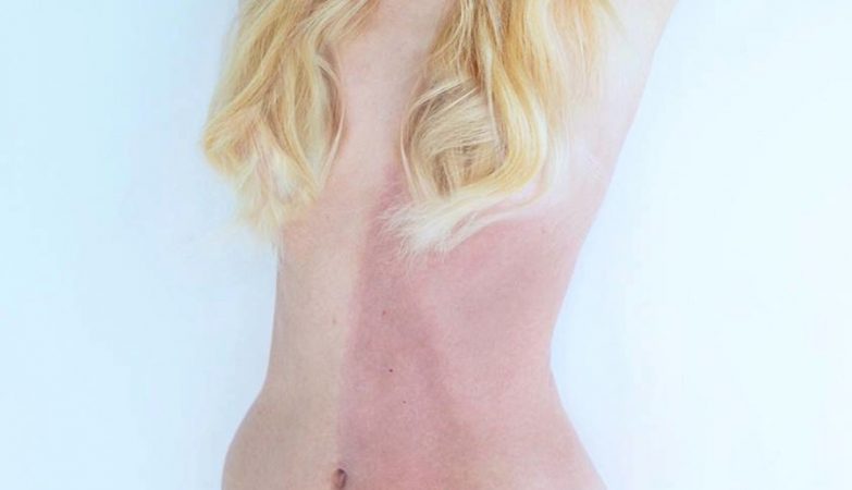 Murder victim found with two sets of DNA due to rare condition