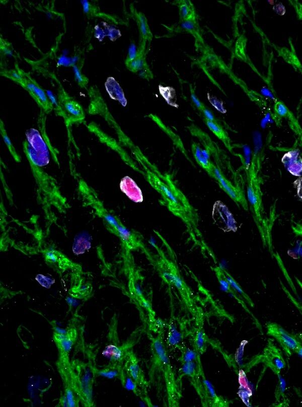 The heart can regenerate itself after a heart attack, new study reveals