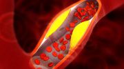 What if your body is already giving you a warning? Six signs that can reveal high cholesterol