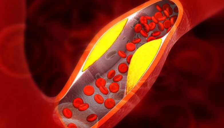 What if your body is already giving you a warning? Six signs that can reveal high cholesterol