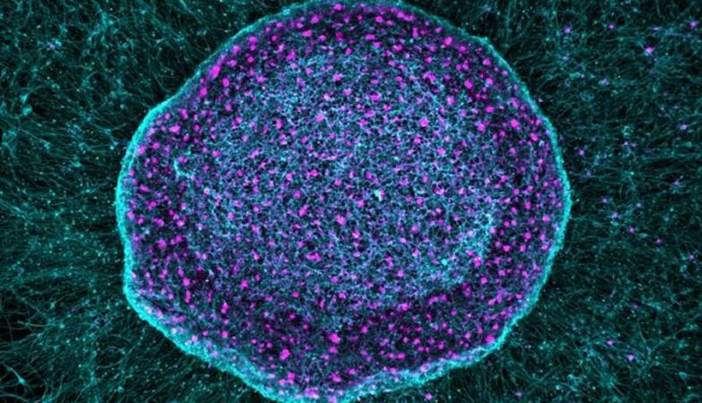 Goodbye painkillers? New “sponge” stops the onset of pain