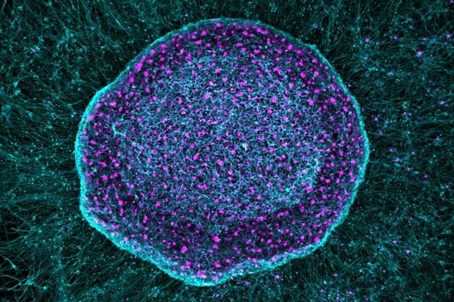 Goodbye painkillers? New “sponge” stops the onset of pain