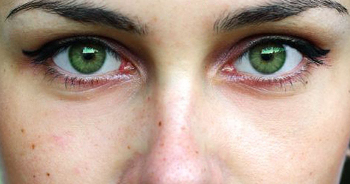 Do you have a mole here? This is a sign that you are the chosen one