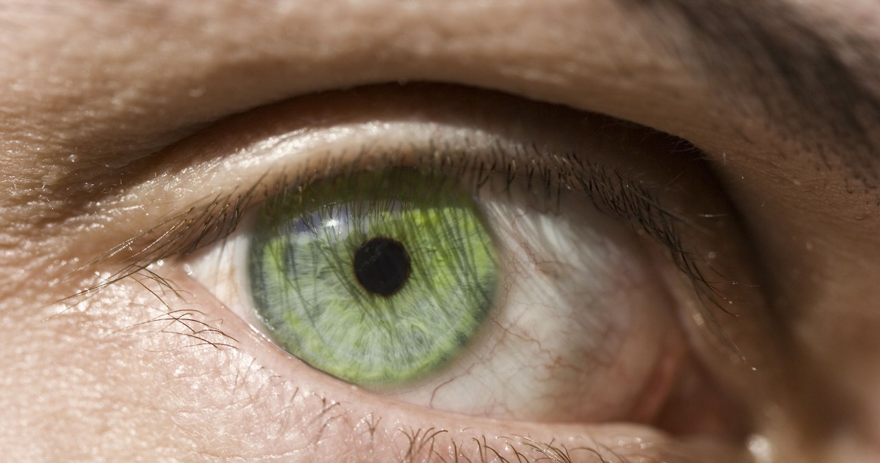 Do you have this eye color? You certainly attract others like a magnet