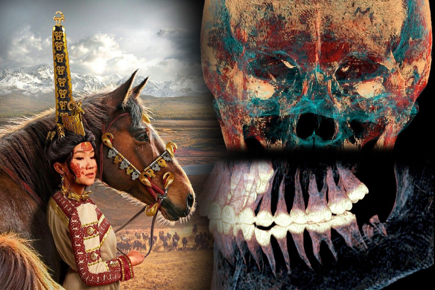 Ancient Altai performed complex surgeries 2,500 years ago