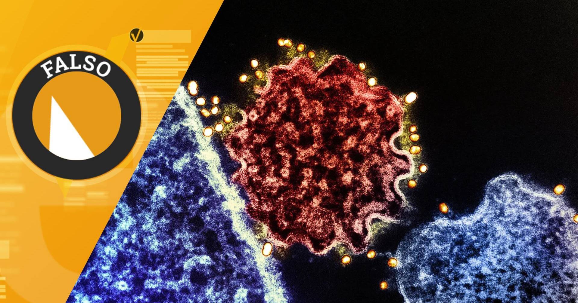 Nipah virus: WHO warned of global risk of infection after Carnival?