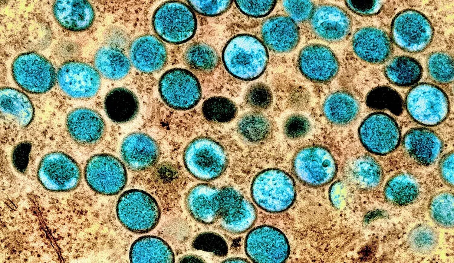 Three viruses that threaten the world in 2026