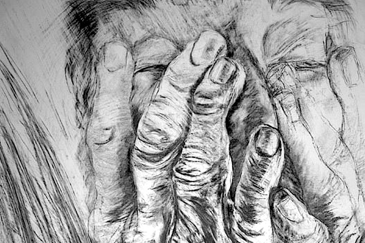 Cancer can save us from… Alzheimer’s