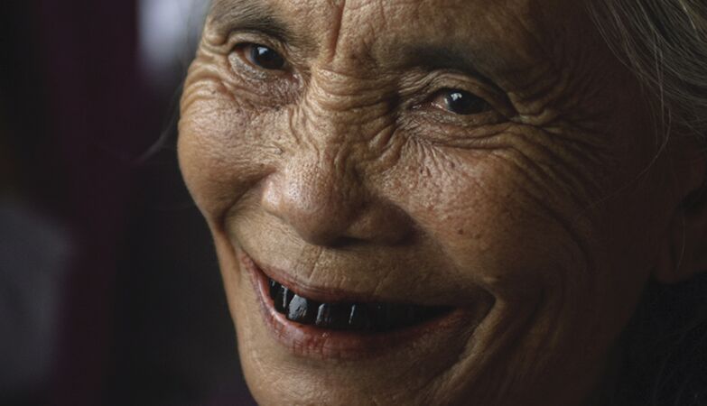 Black teeth: a sign of beauty. Here is the Vietnamese “recipe”