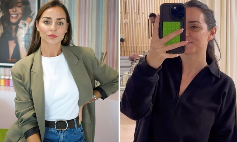 Vanessa Martins shows her face “7 days after” surgery: “This is looking incredible…”