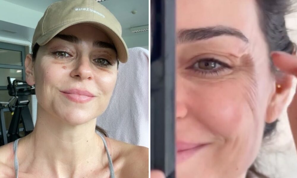 Vanessa Martins reveals why she decided to have an operation on her face: “It bothered me a lot…”