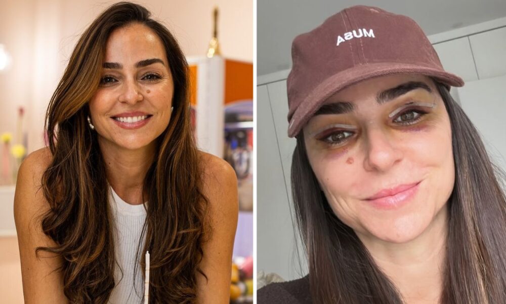 Vanessa Martins leaves a 'message' to critics after cosmetic surgery: “This decision is about me…”