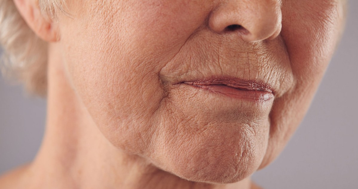 Apply to wrinkles around the mouth. You will forget about Botox for many months