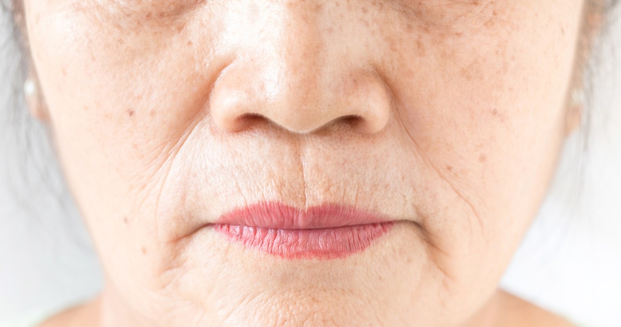 Wrinkles around the mouth can be smoothed out with home remedies /123RF/PICSEL