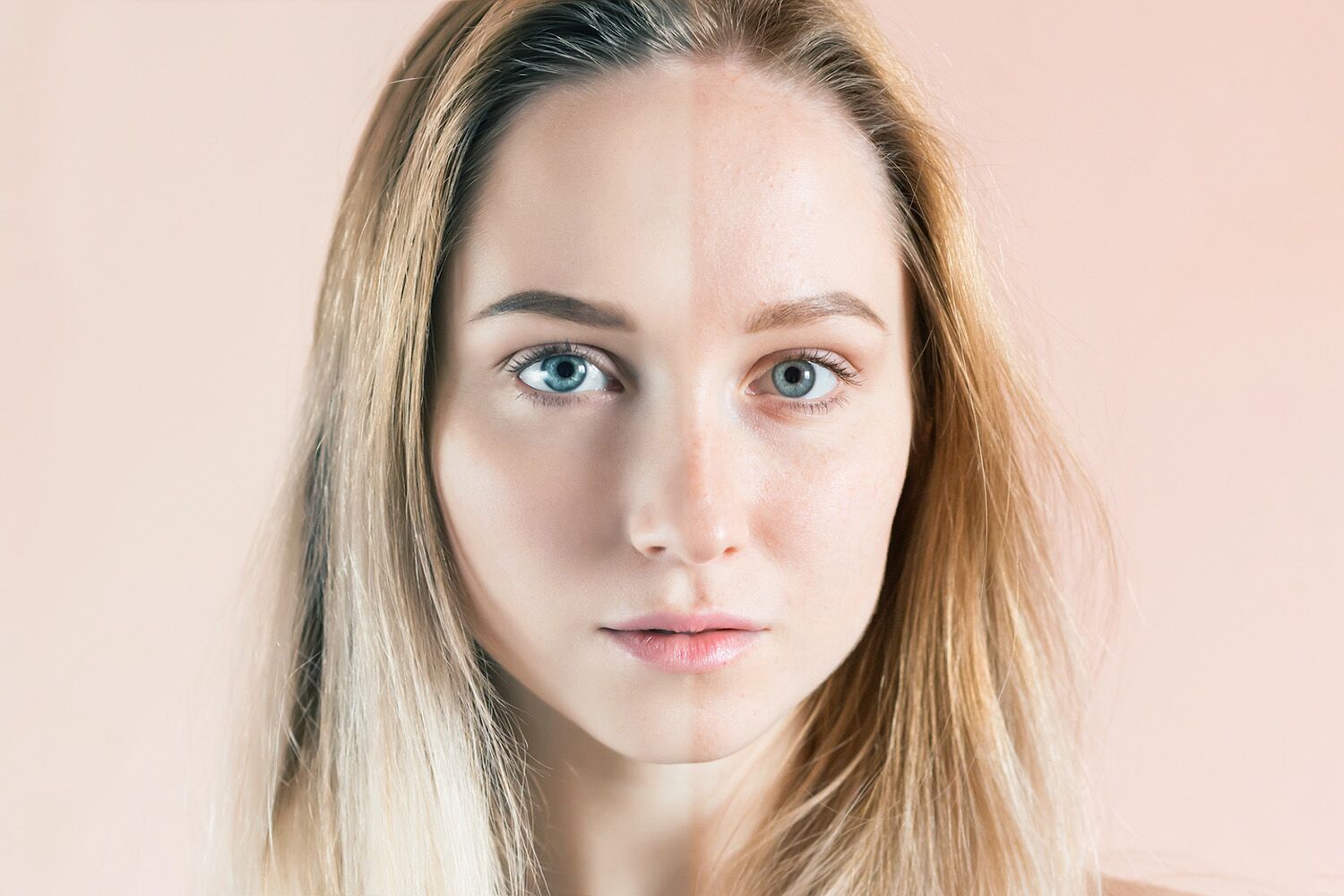 The “Ozempic face” phenomenon has a scientific explanation
