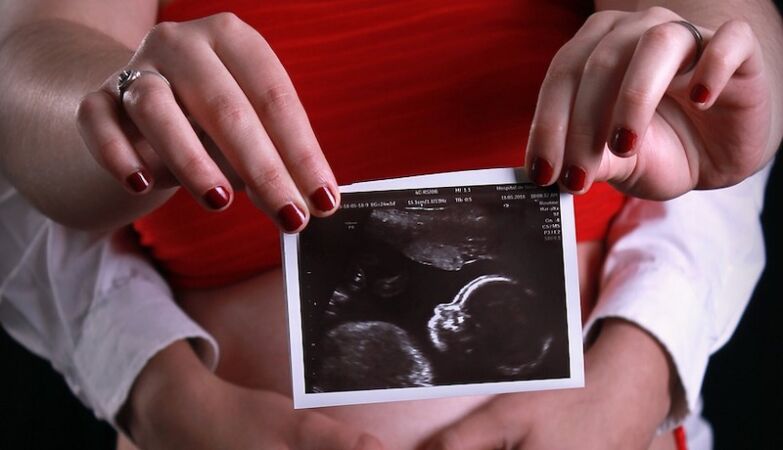 How a woman without a vagina or cervix conceived a child naturally