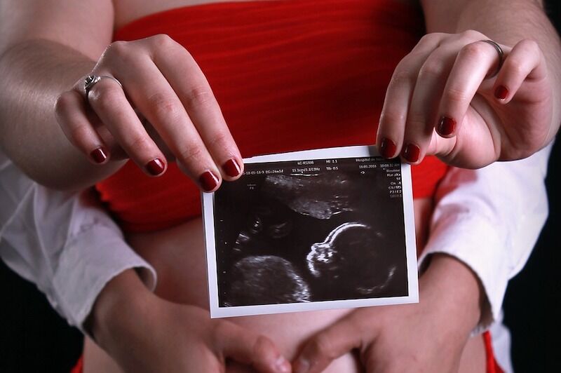 How a woman without a vagina or cervix conceived a child naturally