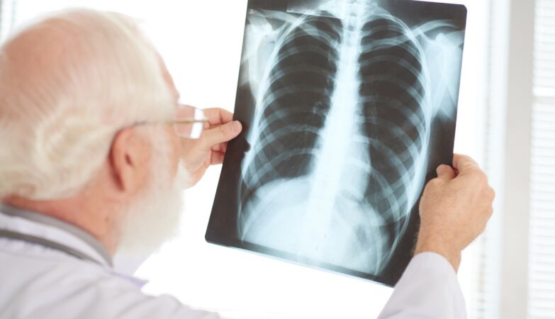 tuberculosis x-ray doctor hospital