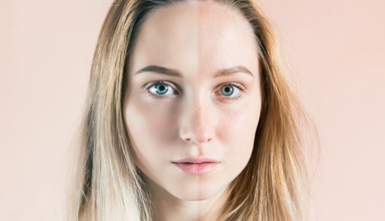 The “Ozempic face” phenomenon has a scientific explanation