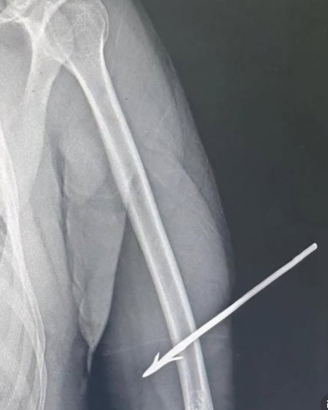 Federal police officer is hit by arrow during operation against illegal mining