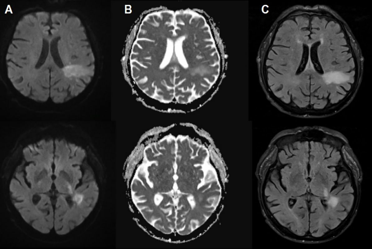 It is very likely that you are infected with a brain-eating virus you have never heard of