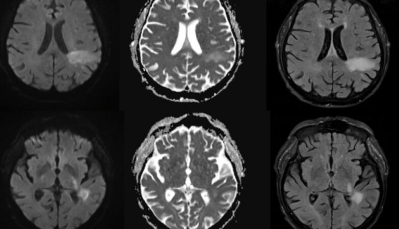 It is very likely that you are infected with a brain-eating virus you have never heard of