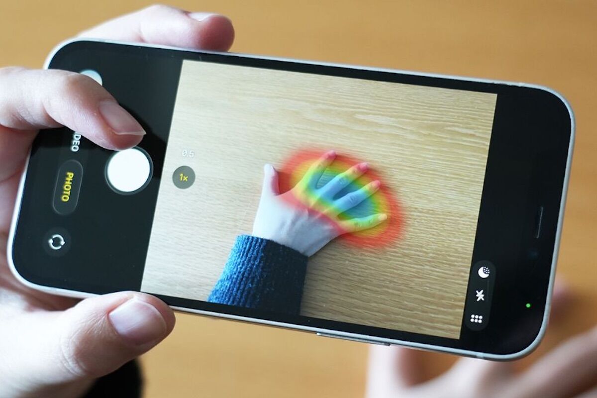 A simple photo of your hand can detect a rare health disorder