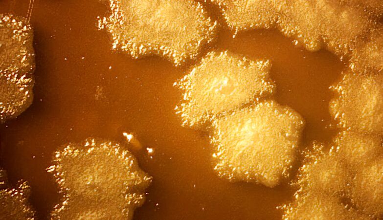 Scientists create bacteria that defeat cancer by devouring tumors (from the inside out)