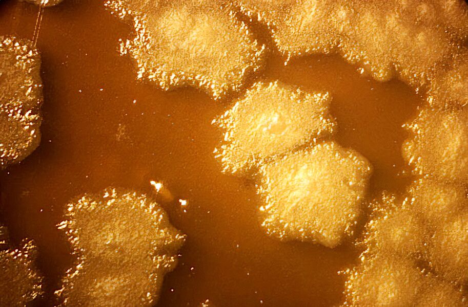 Scientists create bacteria that defeat cancer by devouring tumors (from the inside out)