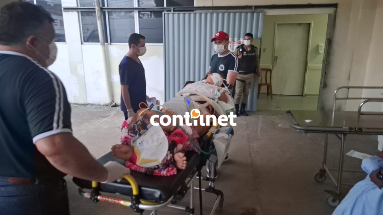 Patient with suspected Mpox is transferred from Brasiléia to Rio Branco; case could be the second on the border