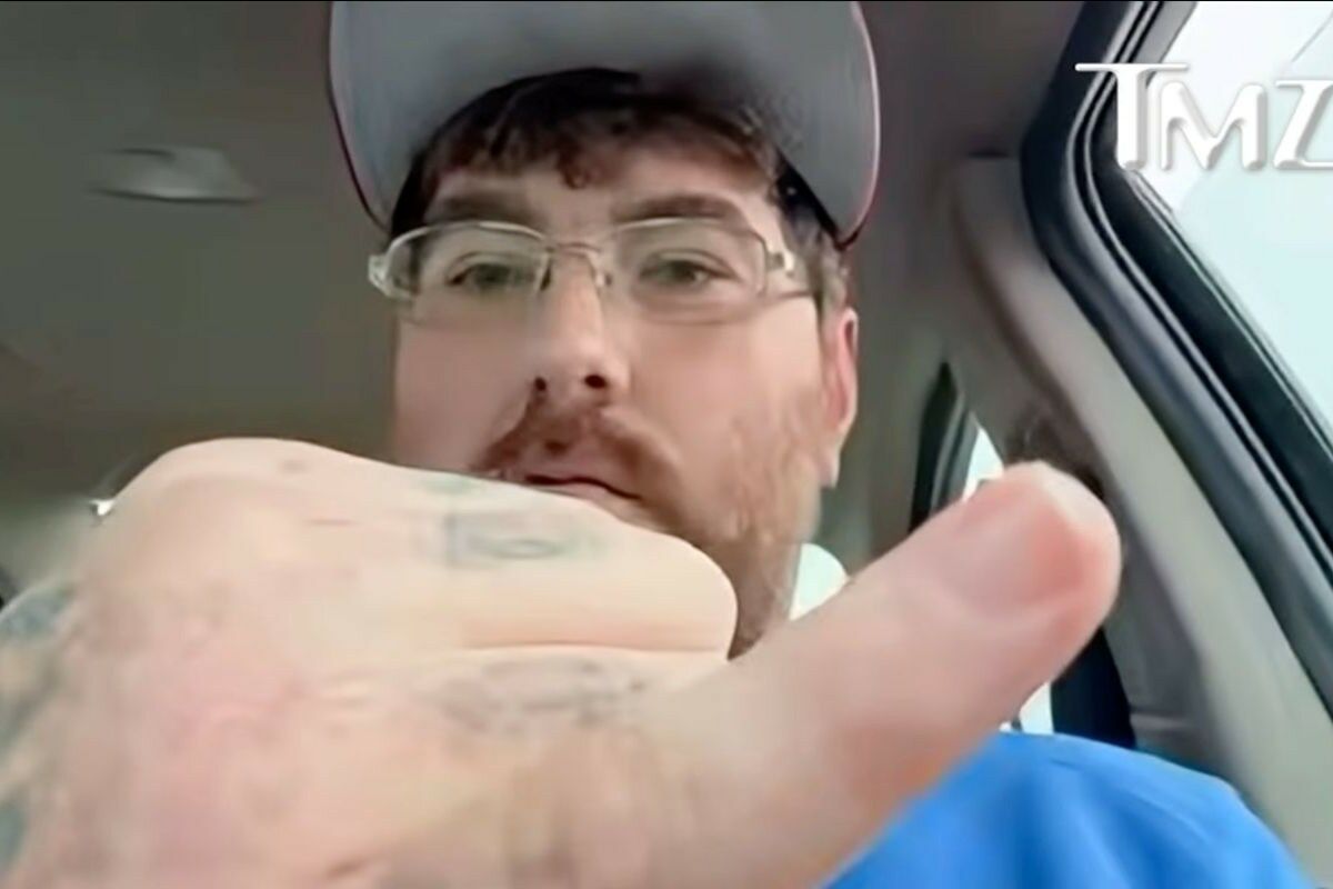 North American says he has the smallest penis in the world and challenges others to beat his mark