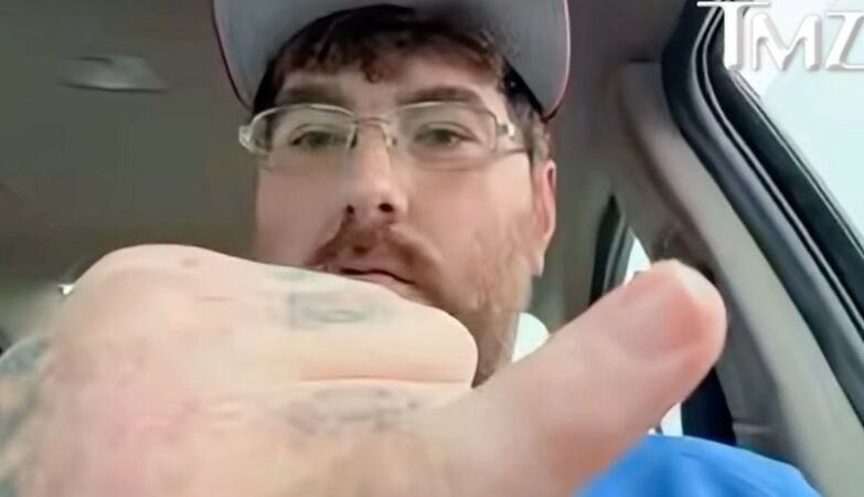 North American says he has the smallest penis in the world and challenges others to beat his mark