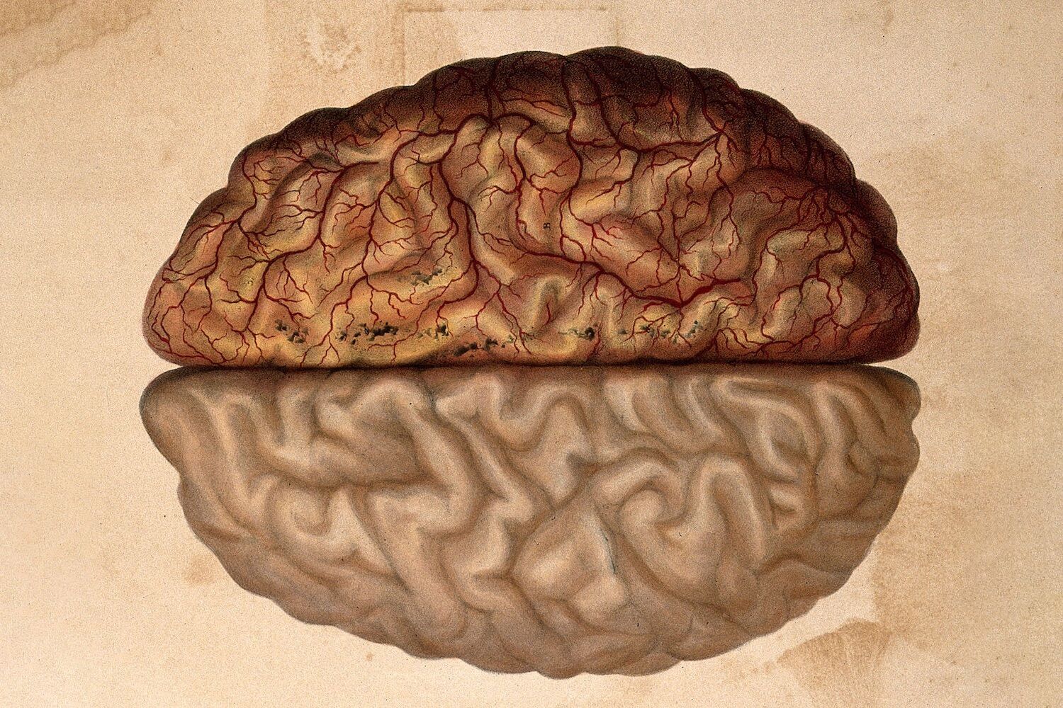 Life after death: preservation of a pig's brain gives hope