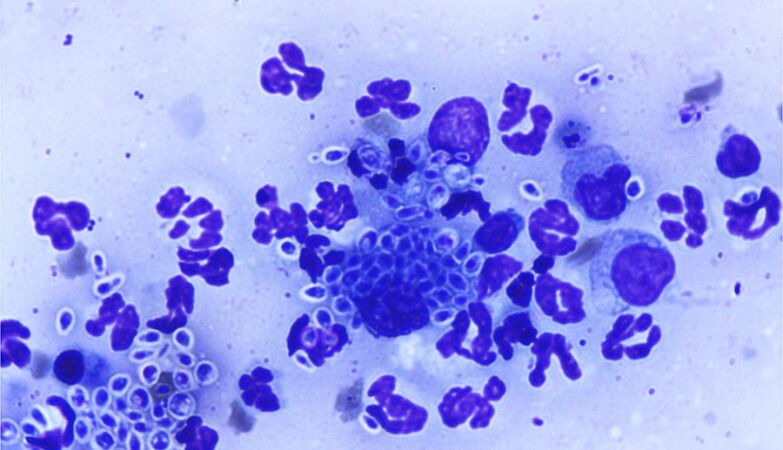 "Alarming". Fungus detected that transmits from cats to humans