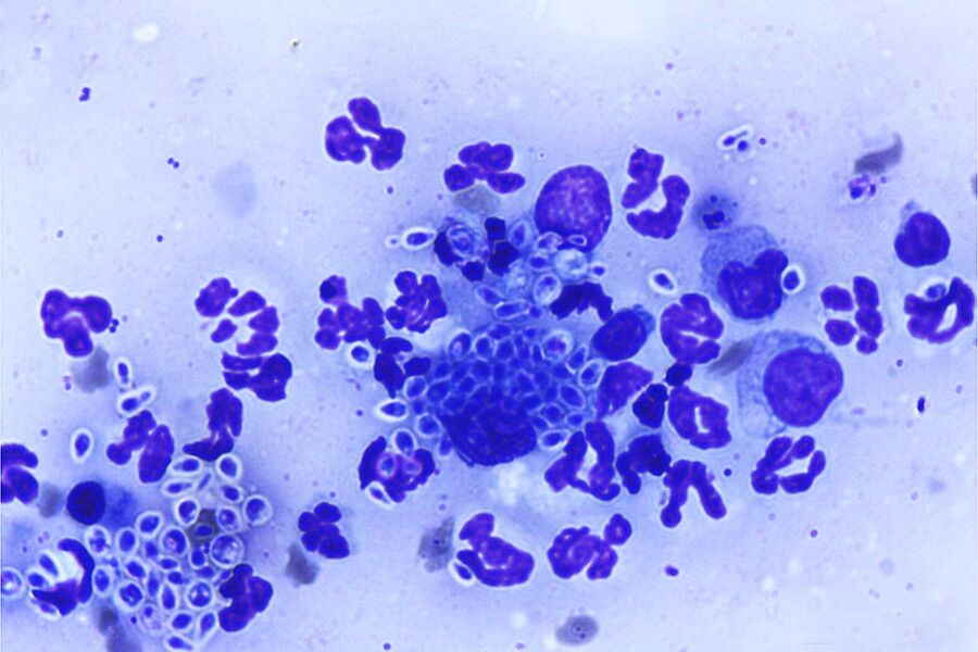 "Alarming". Fungus detected that transmits from cats to humans