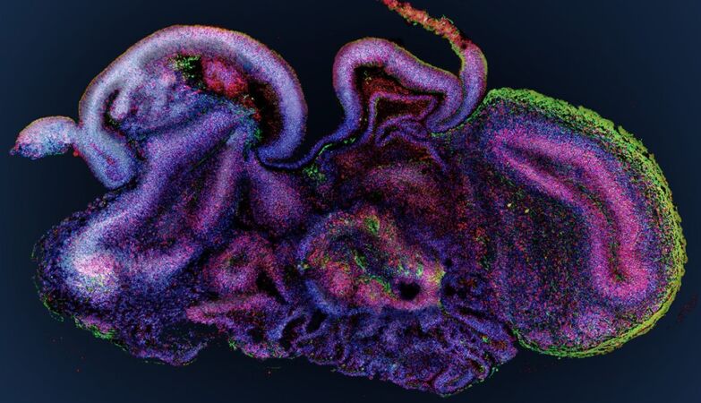 Scientists created mini-brains (and taught them how to solve an engineering problem)