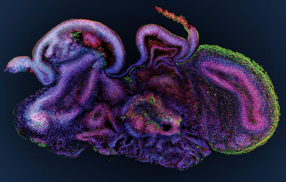 Scientists created mini-brains (and taught them how to solve an engineering problem)