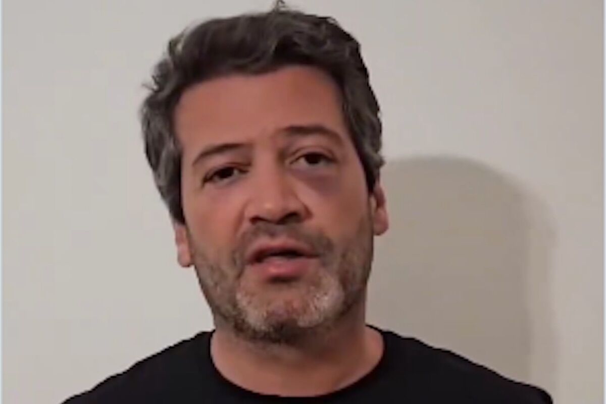 André Ventura appears with black eyes. There was “a setback”