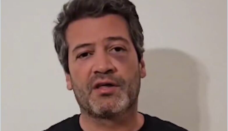 André Ventura appears with black eyes. There was “a setback”