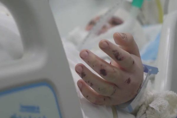 Lebanon: hospitals collapsing to respond to war victims, most of them children