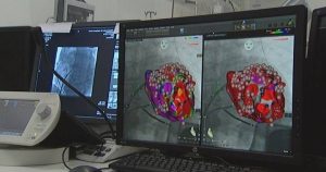 Heart failure: Brazilian research that can accelerate and make treatment safer