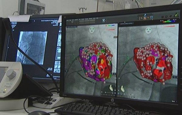Heart failure: Brazilian research that can accelerate and make treatment safer