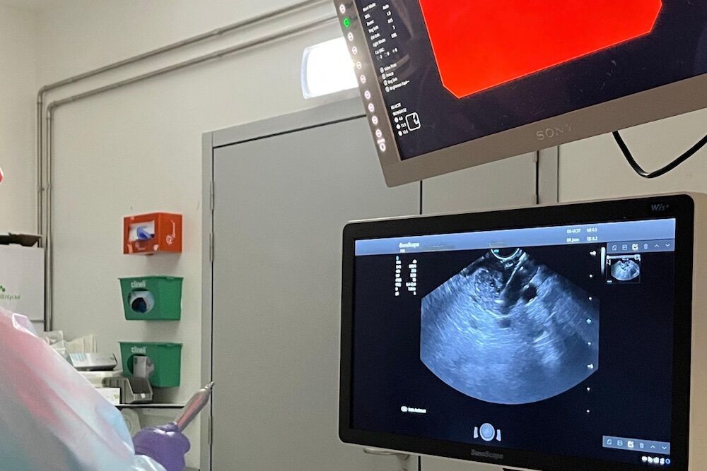 Innovation in Portugal in the fight against pancreatic tumor