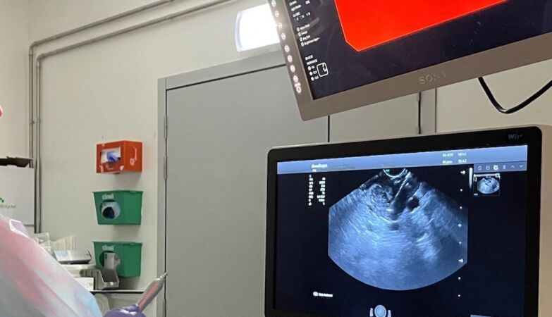 Innovation in Portugal in the fight against pancreatic tumor