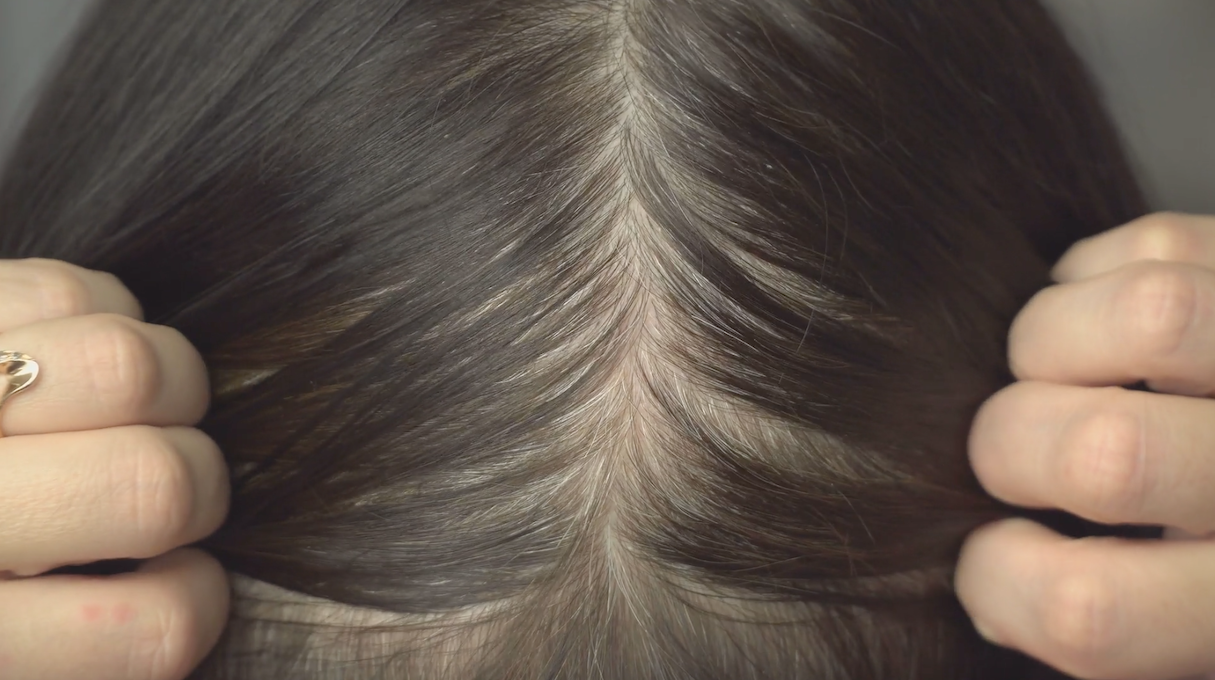 Beware of “no poo”: hair trends can worsen hair loss