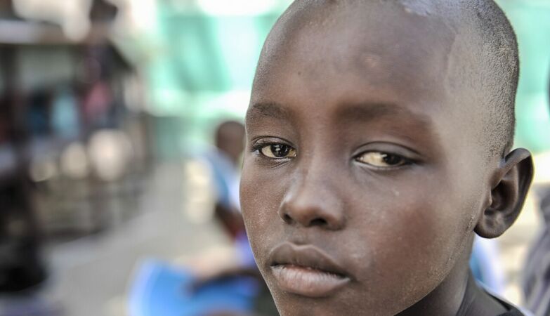 Disaster. “Childhood disappears” in Somalia