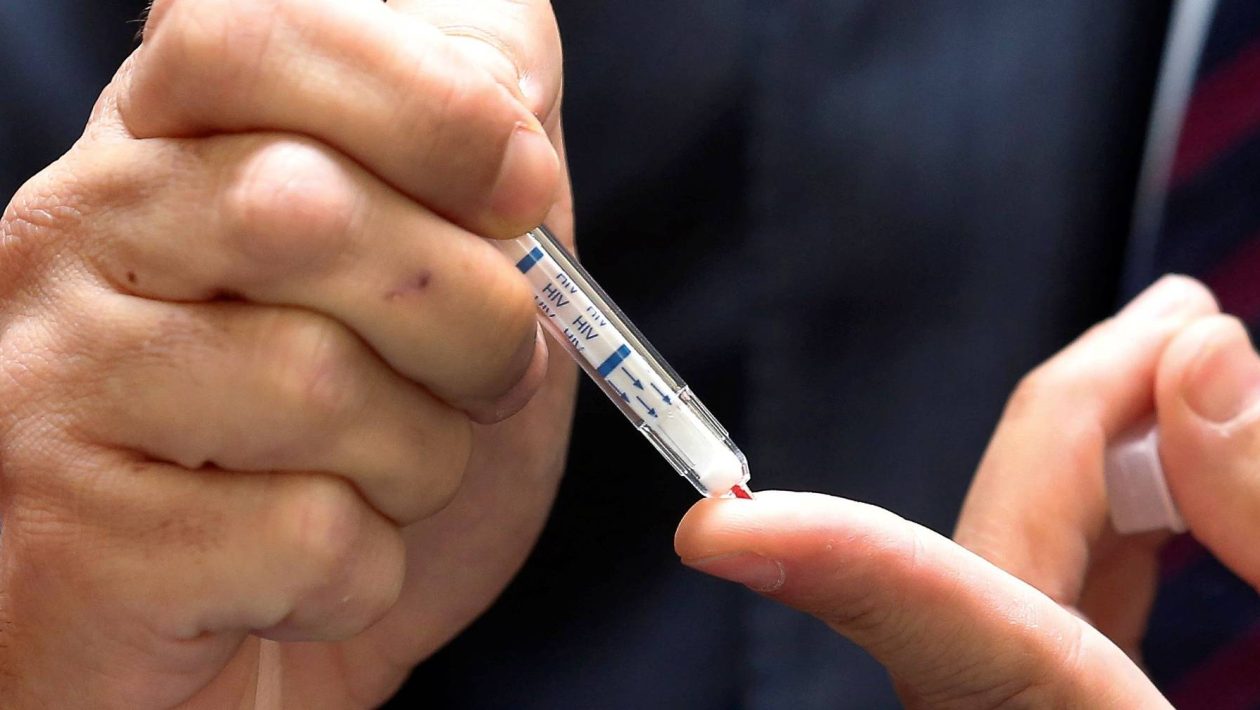 Pharmacies in Greater São Paulo begin offering free tests for HIV and hepatitis