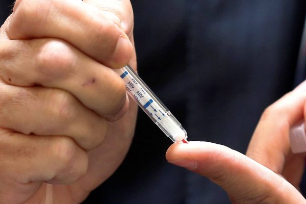 Pharmacies in Greater São Paulo begin offering free tests for HIV and hepatitis